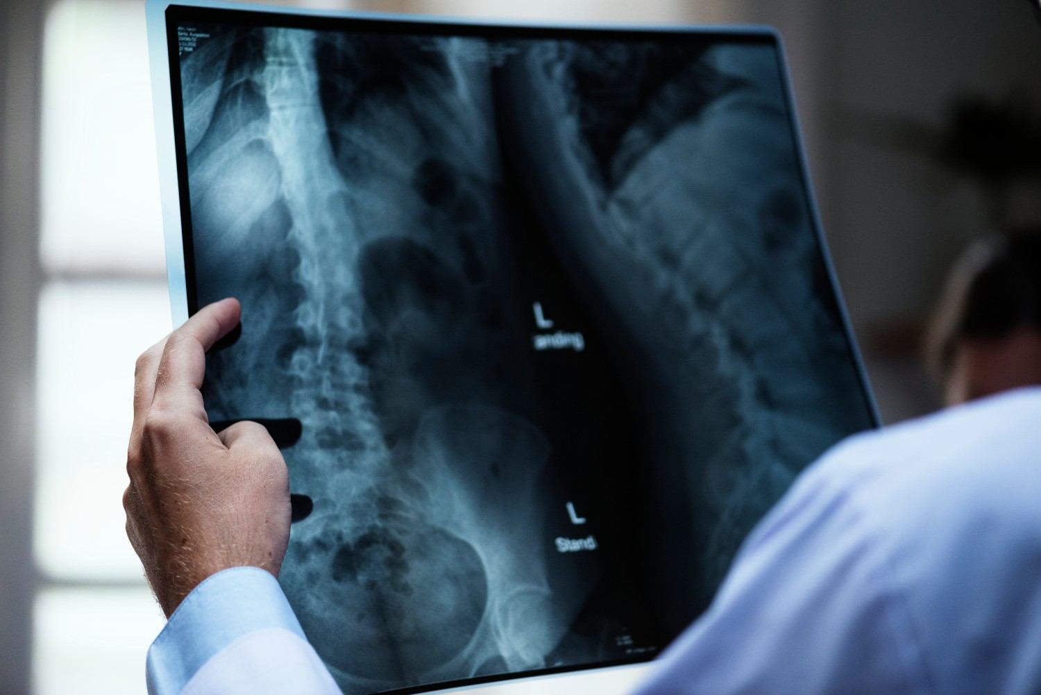When Do You Need Spine Surgery? Signs, Diagnosis, and Treatment Options